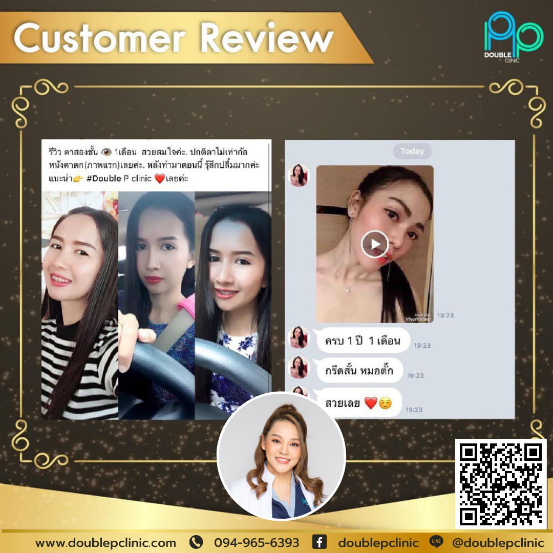 ศัลยกรรมตา ศัลยกรรมตา