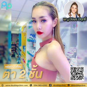 ตาสองชั้น แผลสั้น