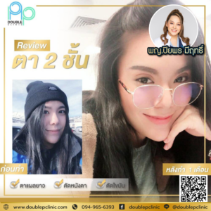 ตาสองช้น กรีดยาว