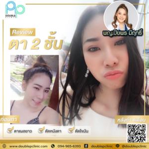 ตาสองช้น กรีดยาว
