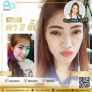 ตาสองช้น กรีดยาว