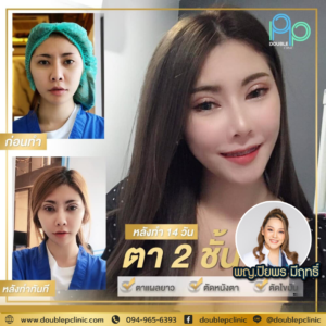 ตาสองช้น กรีดยาว