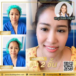 ตาสองช้น กรีดยาว