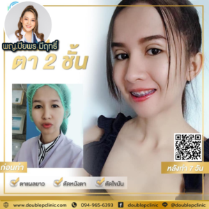 ตาสองช้น กรีดยาว