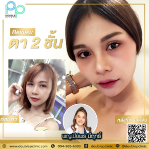 ตาสองช้น กรีดยาว