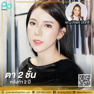 ตาสองช้น กรีดยาว