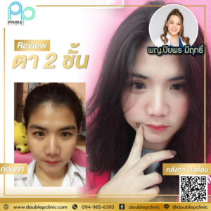 ตาสองช้น กรีดยาว