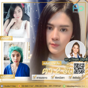 ตาสองช้น กรีดยาว