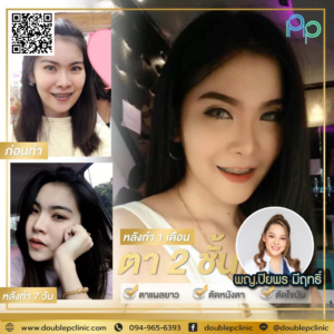 ตาสองช้น กรีดยาว
