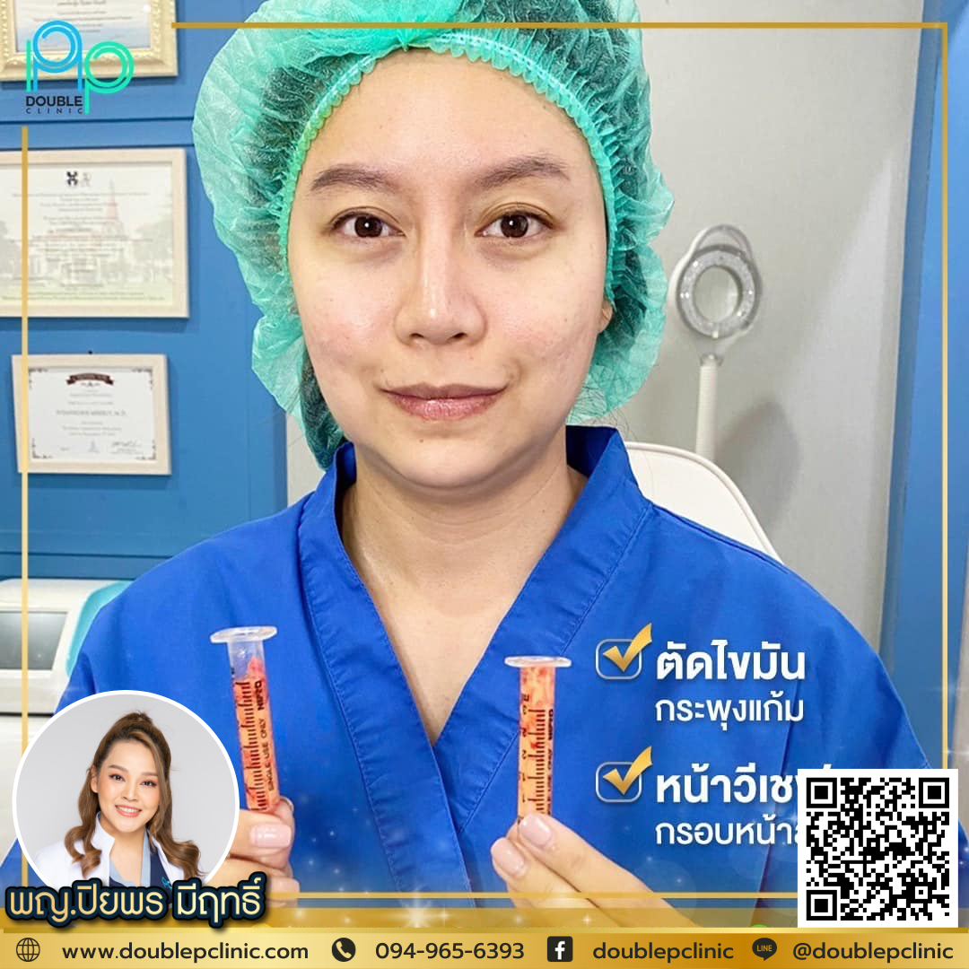 ตัดไขมันกระพุ้งแก้ม แก้ปัญหาหน้าบาน ตัดไขมันกระพุ้งแก้ม แก้ปัญหาหน้าบาน