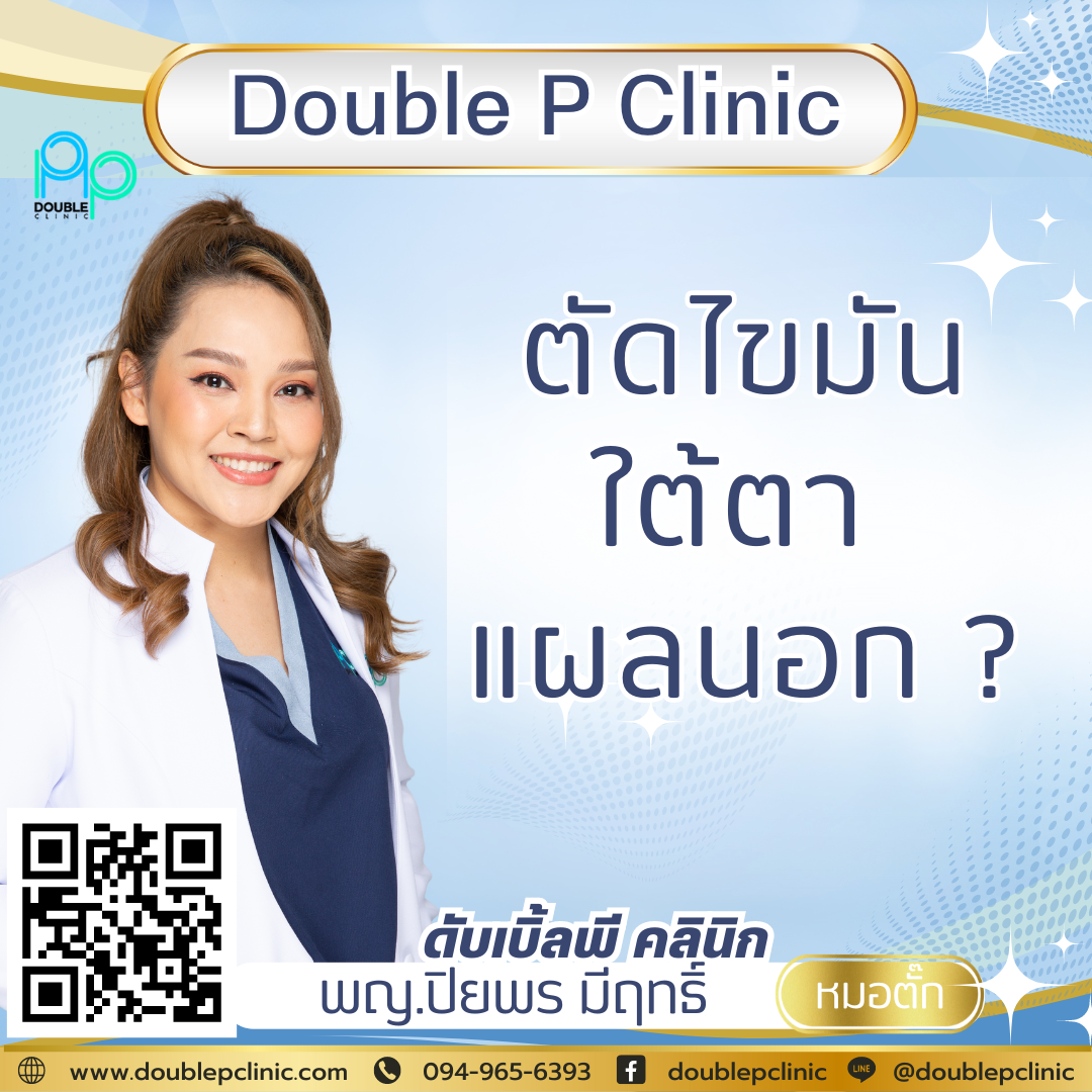 ตัดไขมันใต้ตาแผลนอก ตัดไขมันใต้ตาแผลนอก