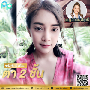 เทคนิคทำตาสองชั้นแบบกรีดสั้น VS กรีดยาว แตกต่างกันอย่างไง