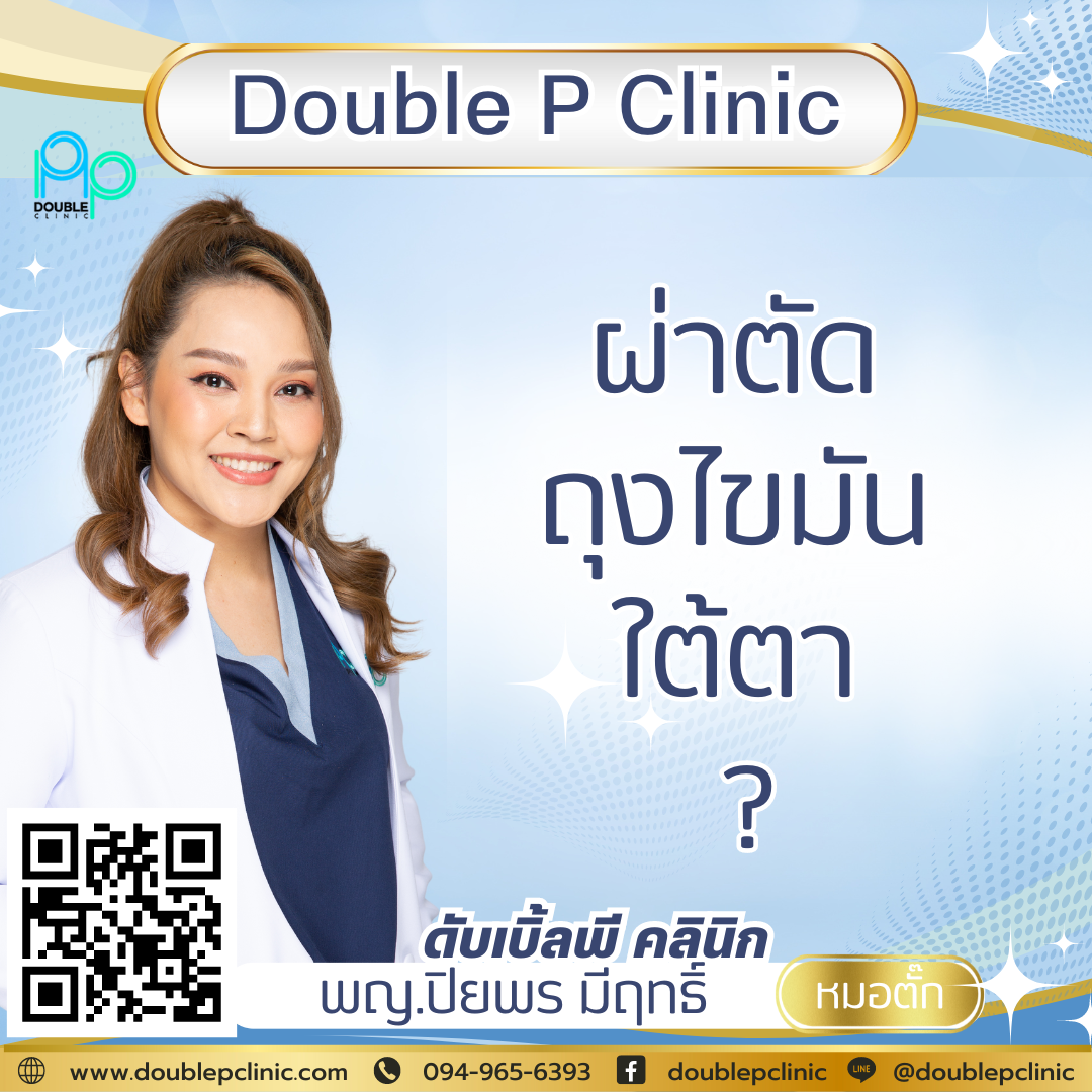 ผ่าตัดถุงไขมันใต้ตา ผ่าตัดถุงไขมันใต้ตา
