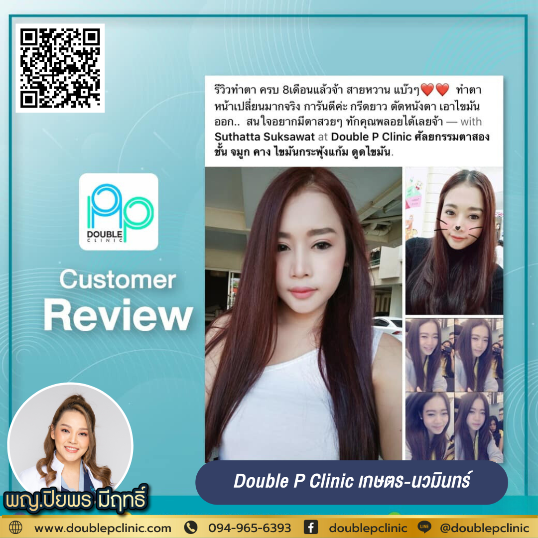 หมอตั๊ก รีวิวตาสองชั้น
