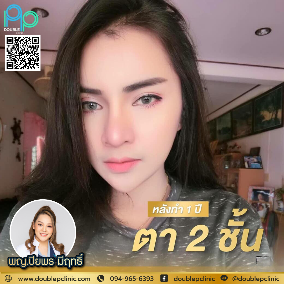 ทำตาสองชั้น แก้ กล้ามเนื้อตาอ่อนแรง 
