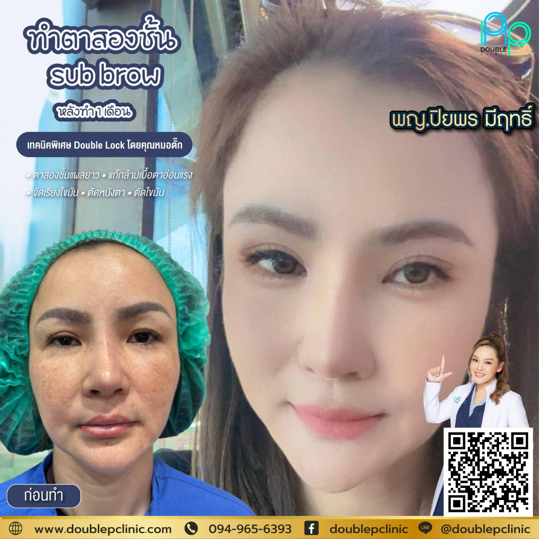 ยกหางตาคืออะไร ยกหางตาคืออะไร