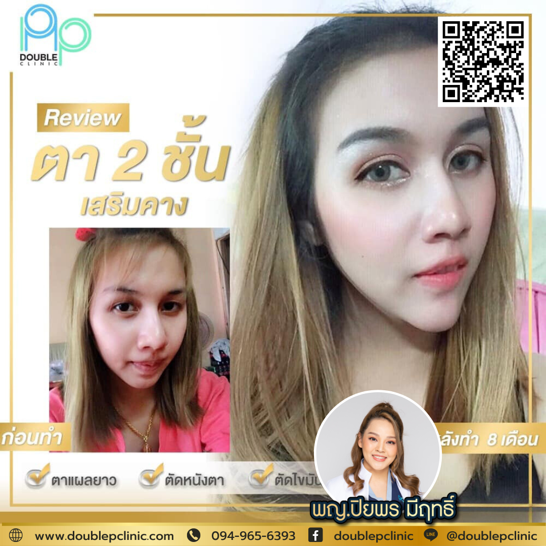 เสริมคางแผลใน กี่วันหาย เสริมคางแผลใน กี่วันหาย