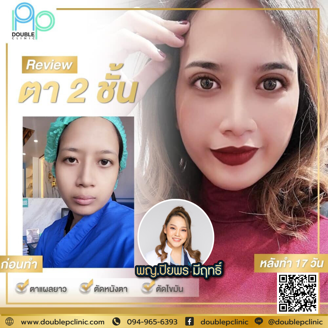 ทำตาสองชั้น กรีดยาว ตกแต่งหนังตา ทำตาสองชั้น กรีดยาว ตกแต่งหนังตา