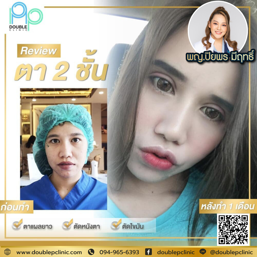 ทำตาสองชั้น กรีดยาว ตกแต่งหนังตา ทำตาสองชั้น กรีดยาว ตกแต่งหนังตา