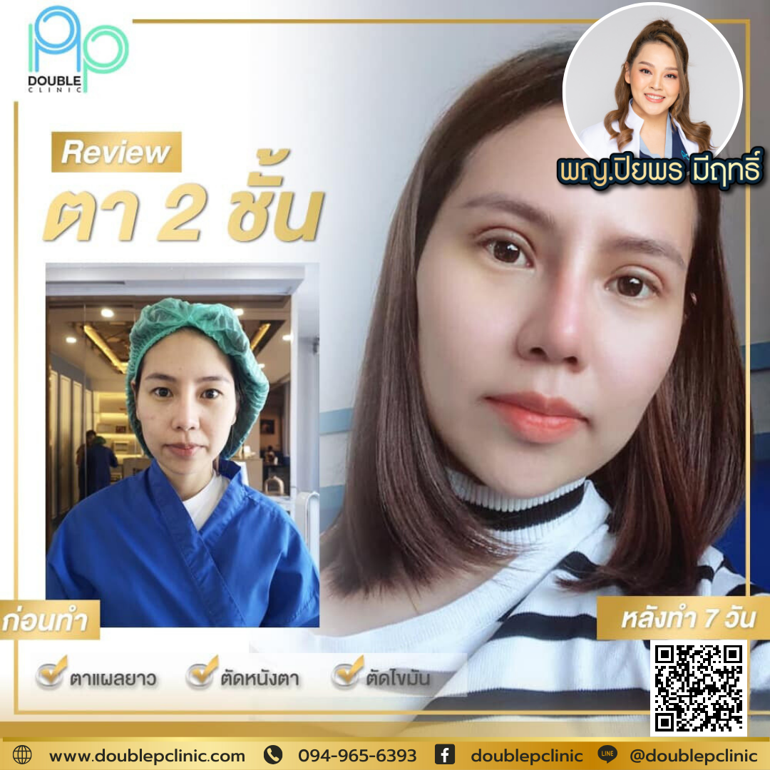 ทำตาสองชั้น กรีดยาว ตกแต่งหนังตา ทำตาสองชั้น กรีดยาว ตกแต่งหนังตา