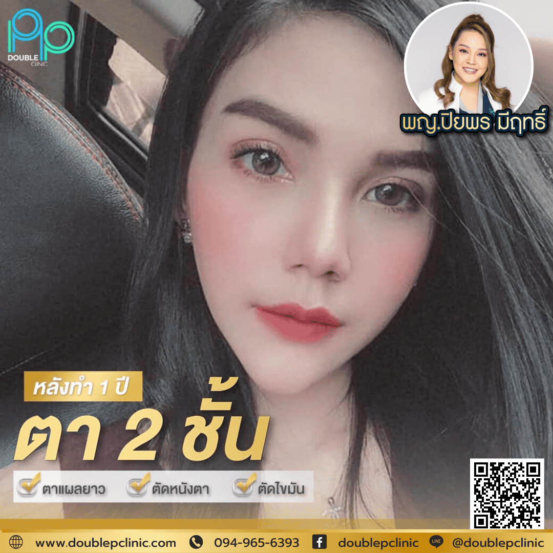 ศัลยกรรมแก้ไขหนังตาตก ศัลยกรรมแก้ไขหนังตาตก