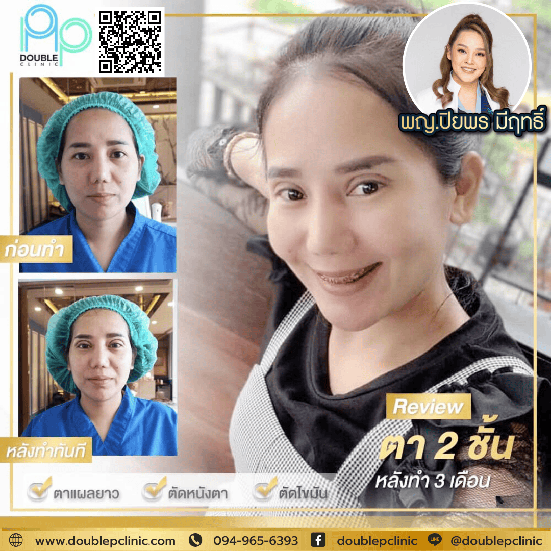 ทําตาสองชั้นแล้วหน้าแก่ ทําตาสองชั้นแล้วหน้าแก่