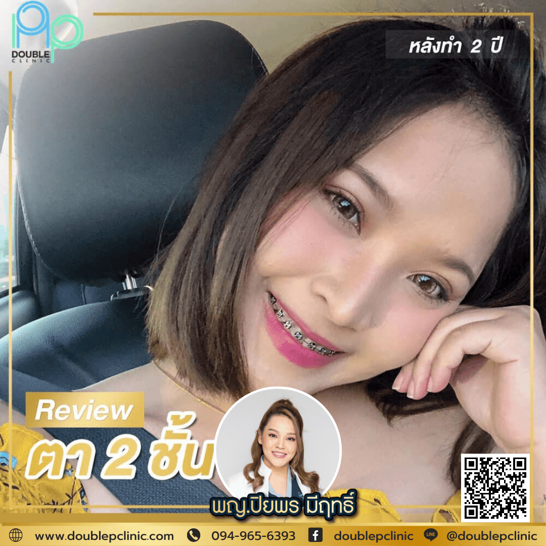 ทําตาสองชั้นแล้วหน้าแก่ ทําตาสองชั้นแล้วหน้าแก่