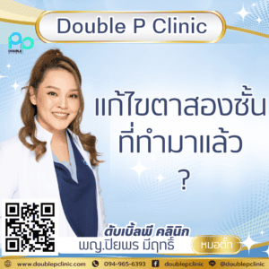 แก้ไขตาสองชั้น ที่ทำมาแล้ว