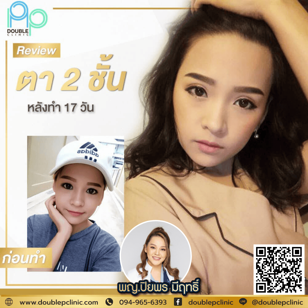 ศัลยกรรม พิษณุโลก ที่ไหนดี