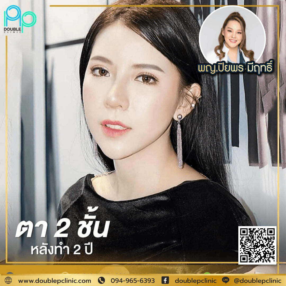 ตาสองชั้น กรีดสั้น คืออะไร ทำอย่างไร