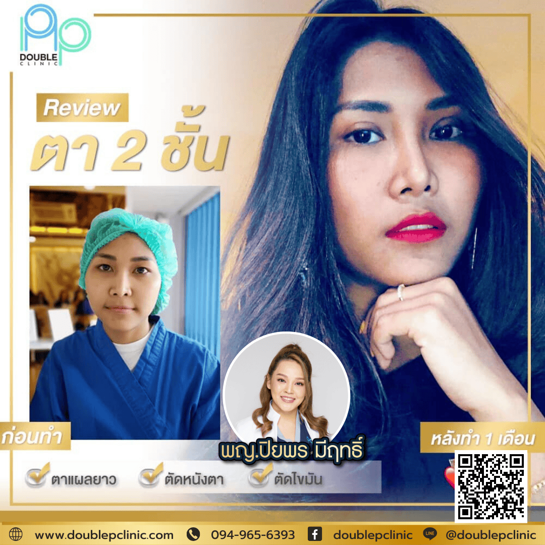 ทำตา 2 ชั้น พิษณุโลก