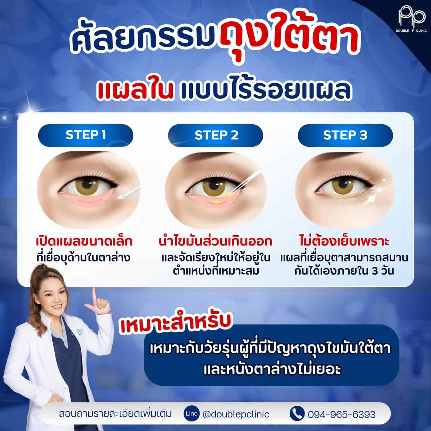 การทำศัลยกรรม ถุงใต้ตา แบบแผลใน 