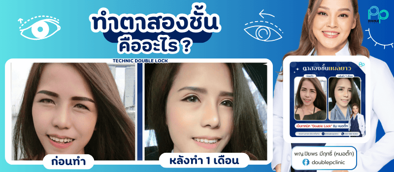 ทำตาสองชั้นคืออะไร ทำตาสองชั้นคืออะไร