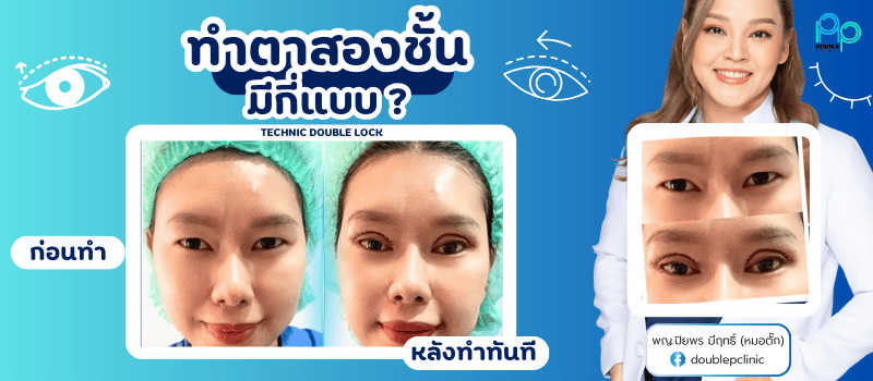 ทำตาสองชั้นมีกี่แบบ ทำตาสองชั้นมีกี่แบบ