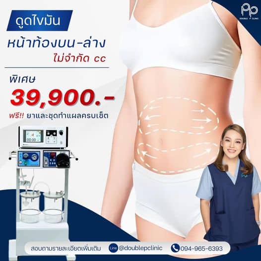 ดูดไขมันหน้าท้อง Abdominal Liposuction