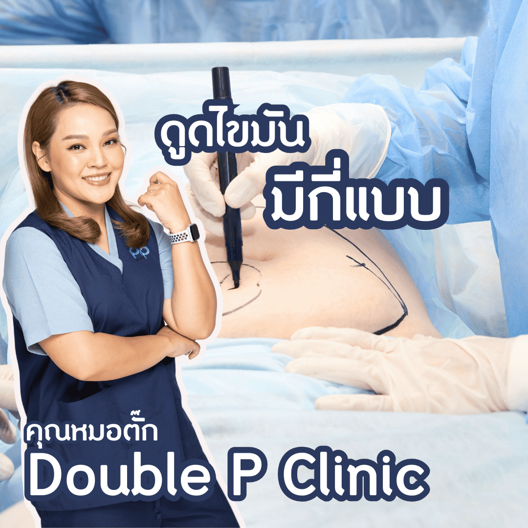 ดูดไขมัน มีกี่แบบ