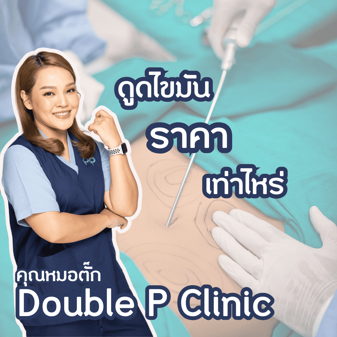 ดูดไขมัน ราคาเท่าไหร่