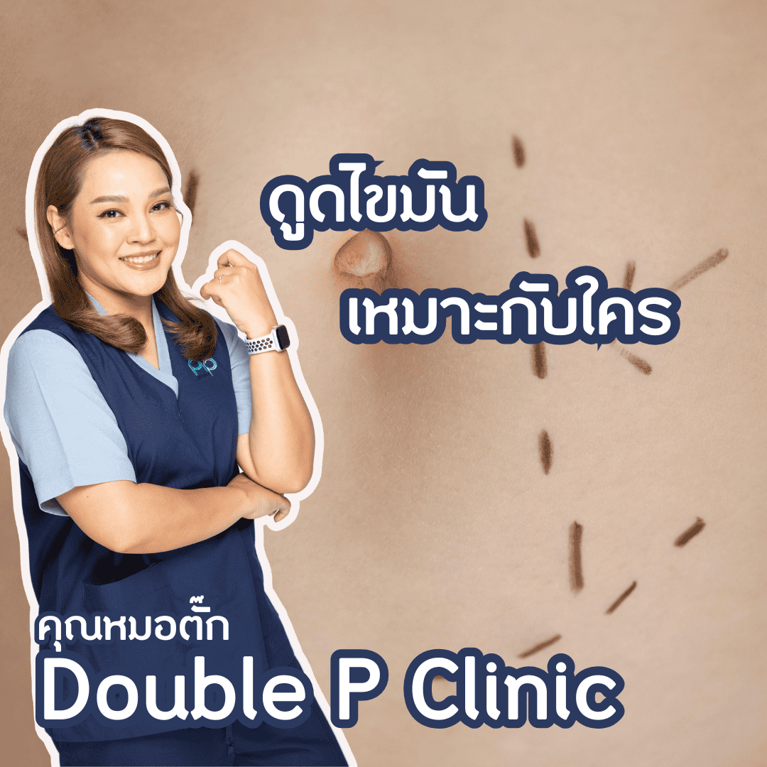 ดูดไขมัน เหมาะกับใคร