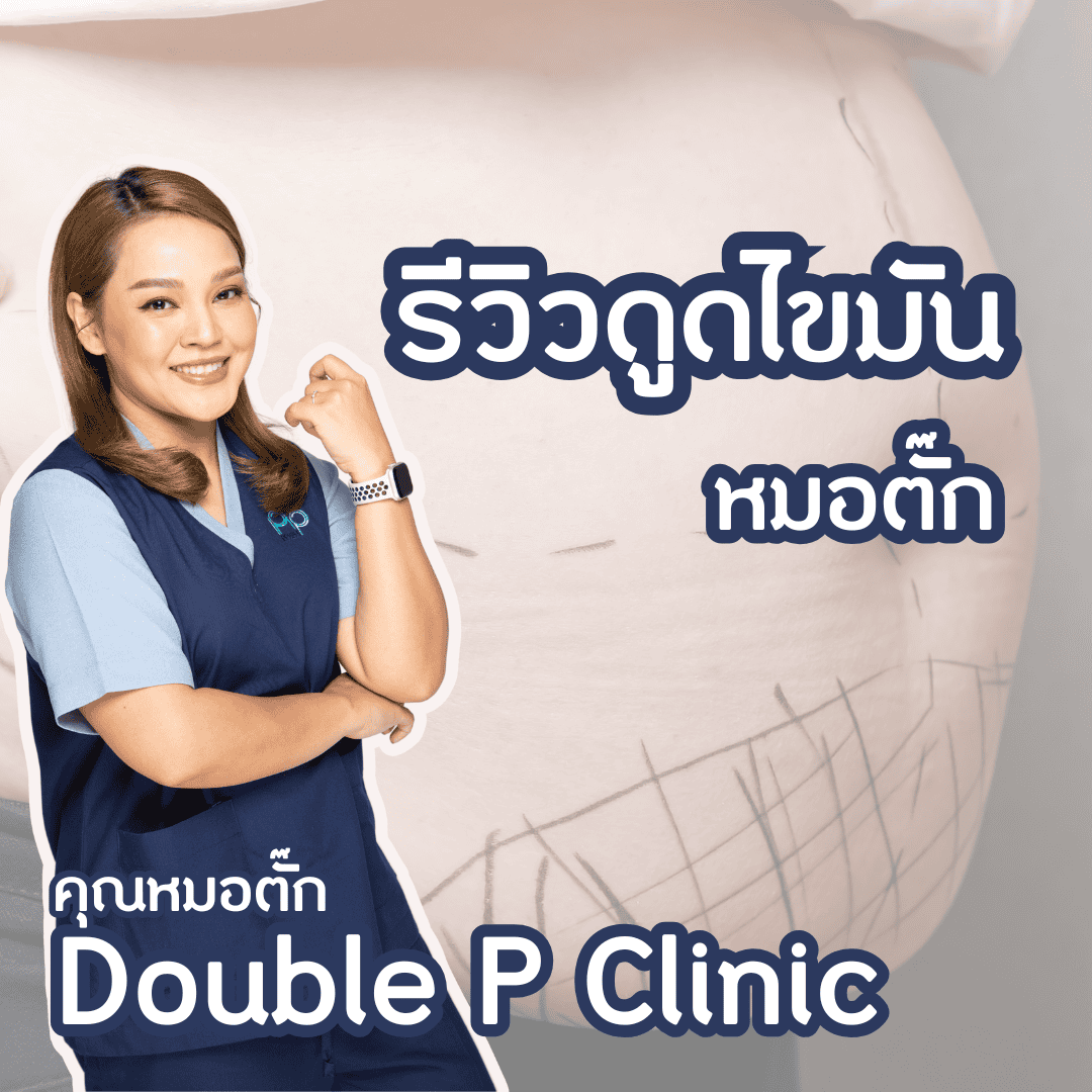 รีวิวดูดไขมัน หมอตั๊ก