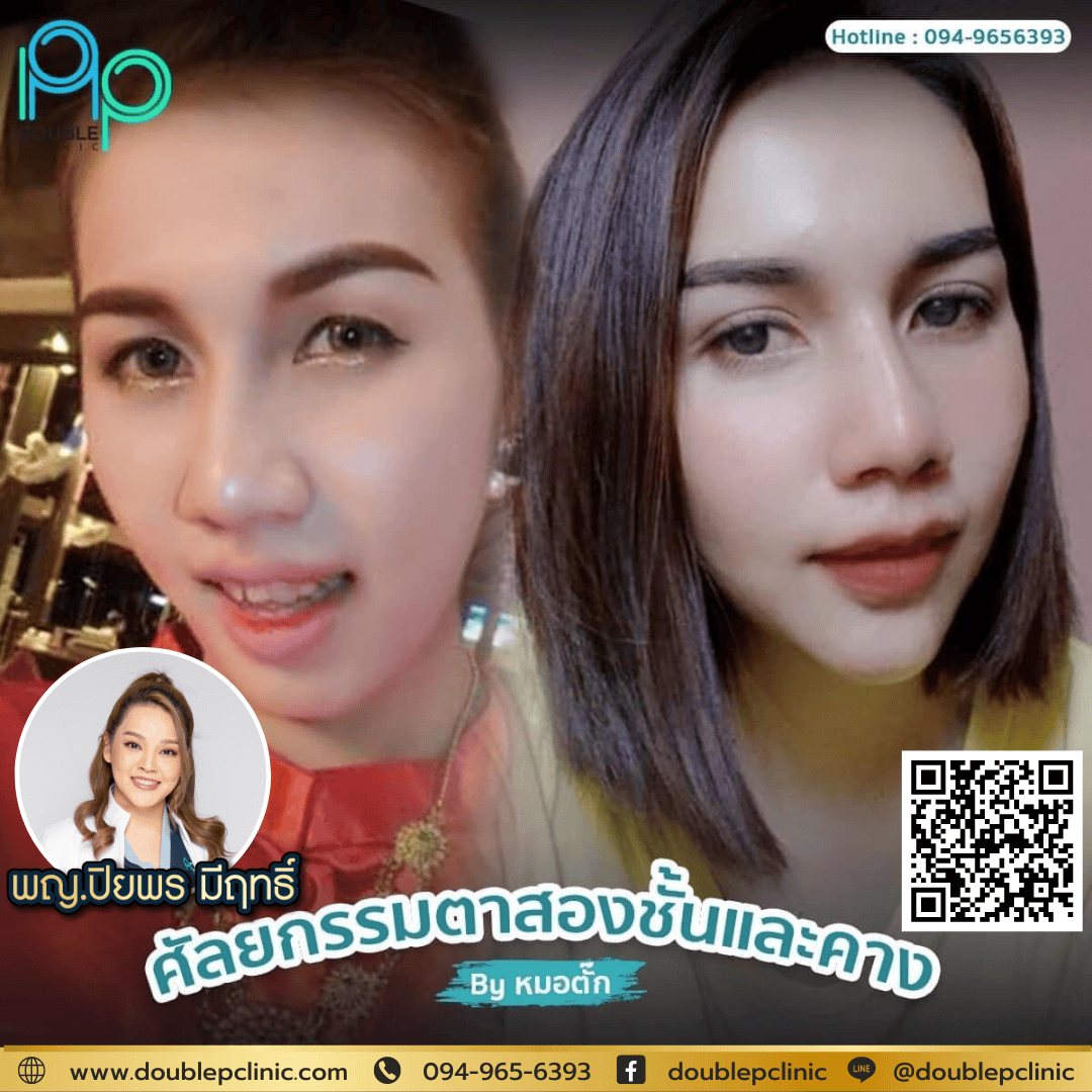 เสริมคางแผลใน ทำไมถึงไม่มีรอยแผลเป็น?
