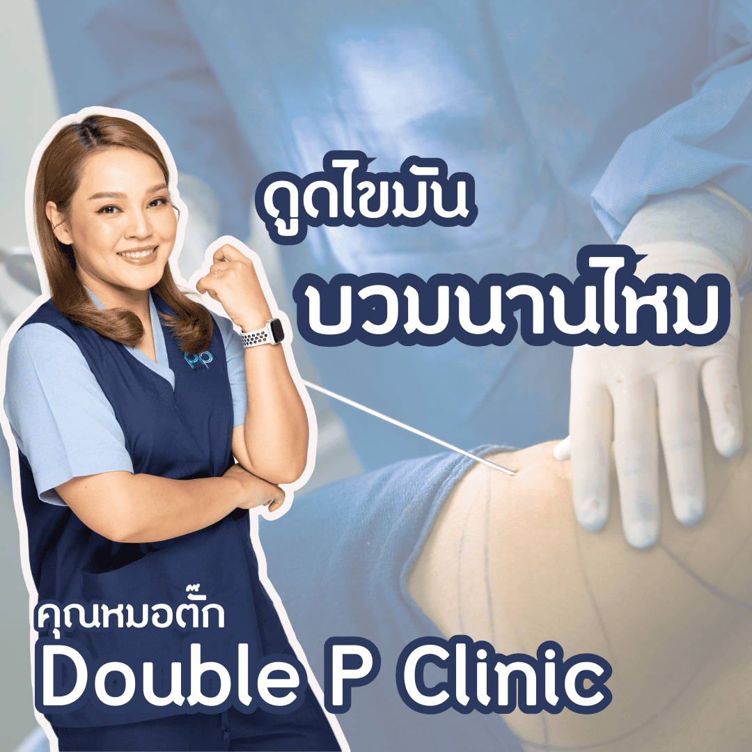 ดูดไขมัน บวมนานไหม