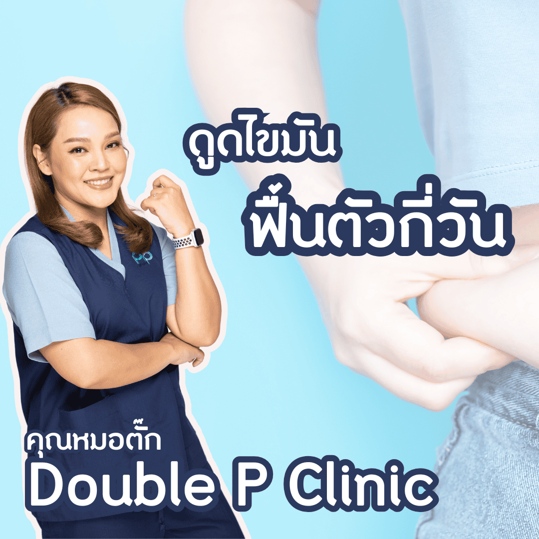 ดูดไขมัน ฟื้นตัวกี่วัน