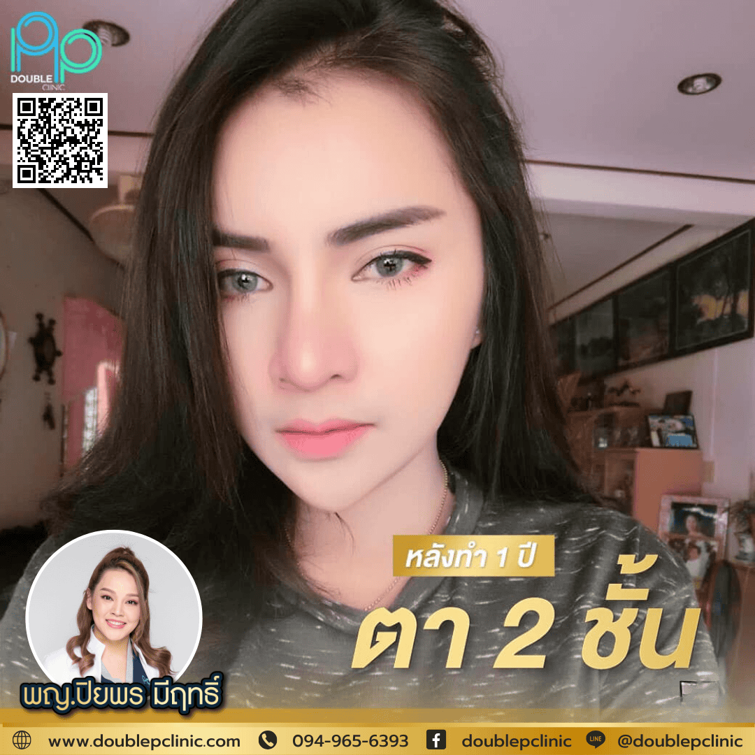 ทำตาสองชั้น กรีดยาว แตกต่างจากกรีดสั้นอย่างไร