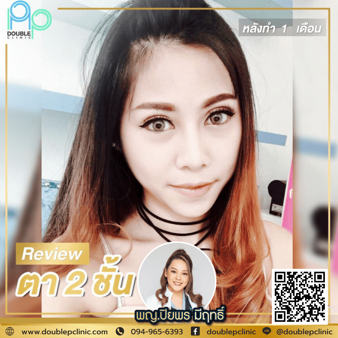 ทำตาสองชั้น แผลสั้น