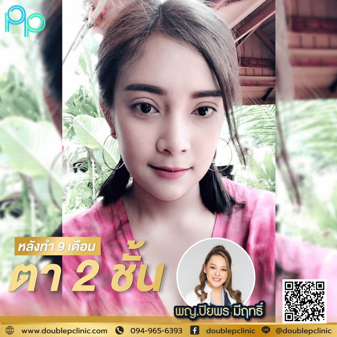 ทำตาสองชั้น แผลสั้น