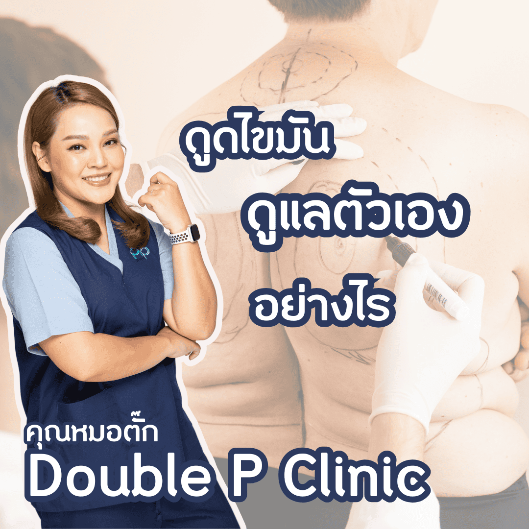 หลัง ดูดไขมัน ดูแลตัวเองอย่างไร
