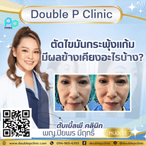 ตัดไขมันกระพุ้งแก้ม มีผลข้างเคียงอะไรบ้าง? 