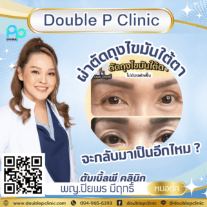  ผ่าตัดถุงไขมันใต้ตา จะกลับมาเป็นอีกไหม ?