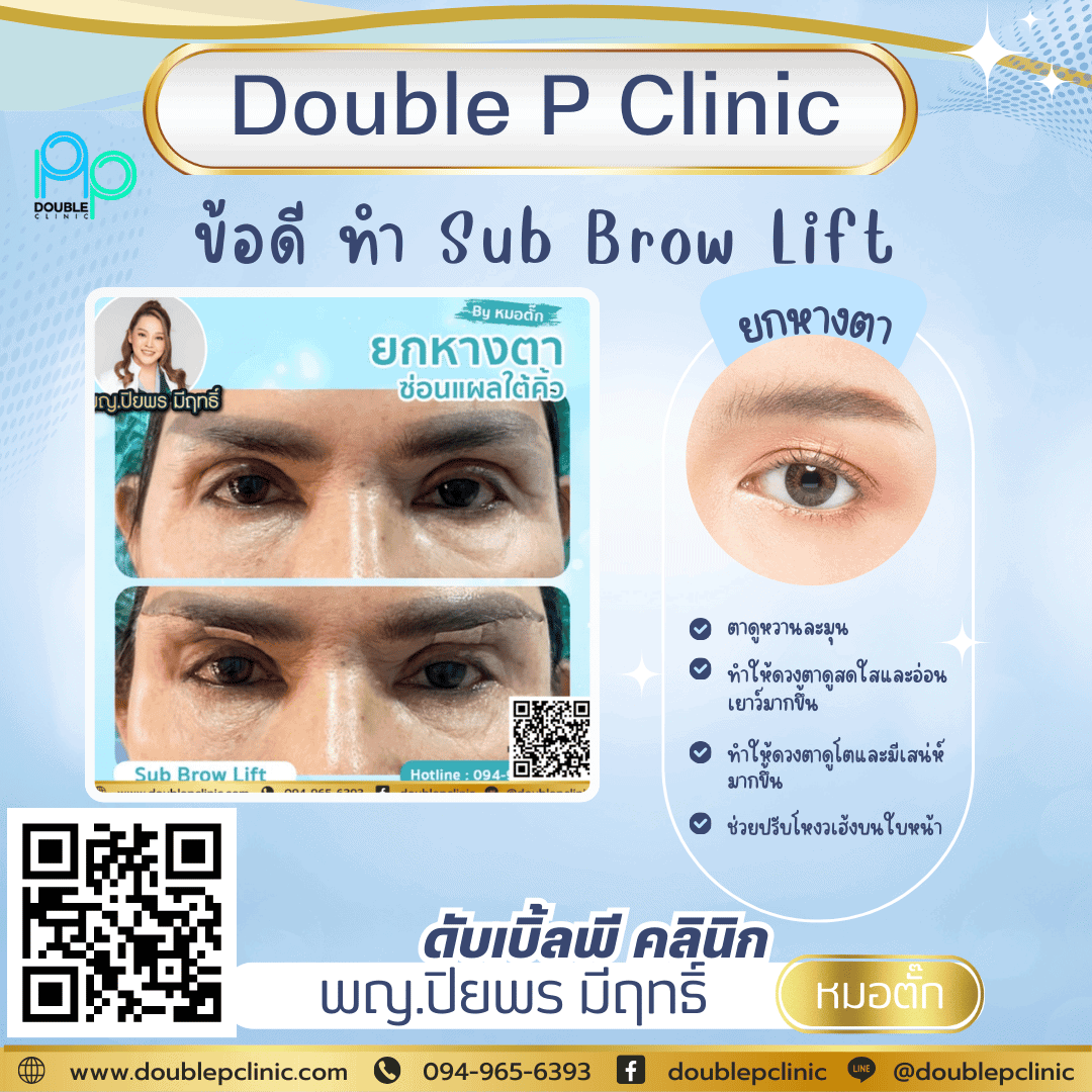 ศัลยกรรมยกหางตา Sub Brow Lift คืออะไร?
