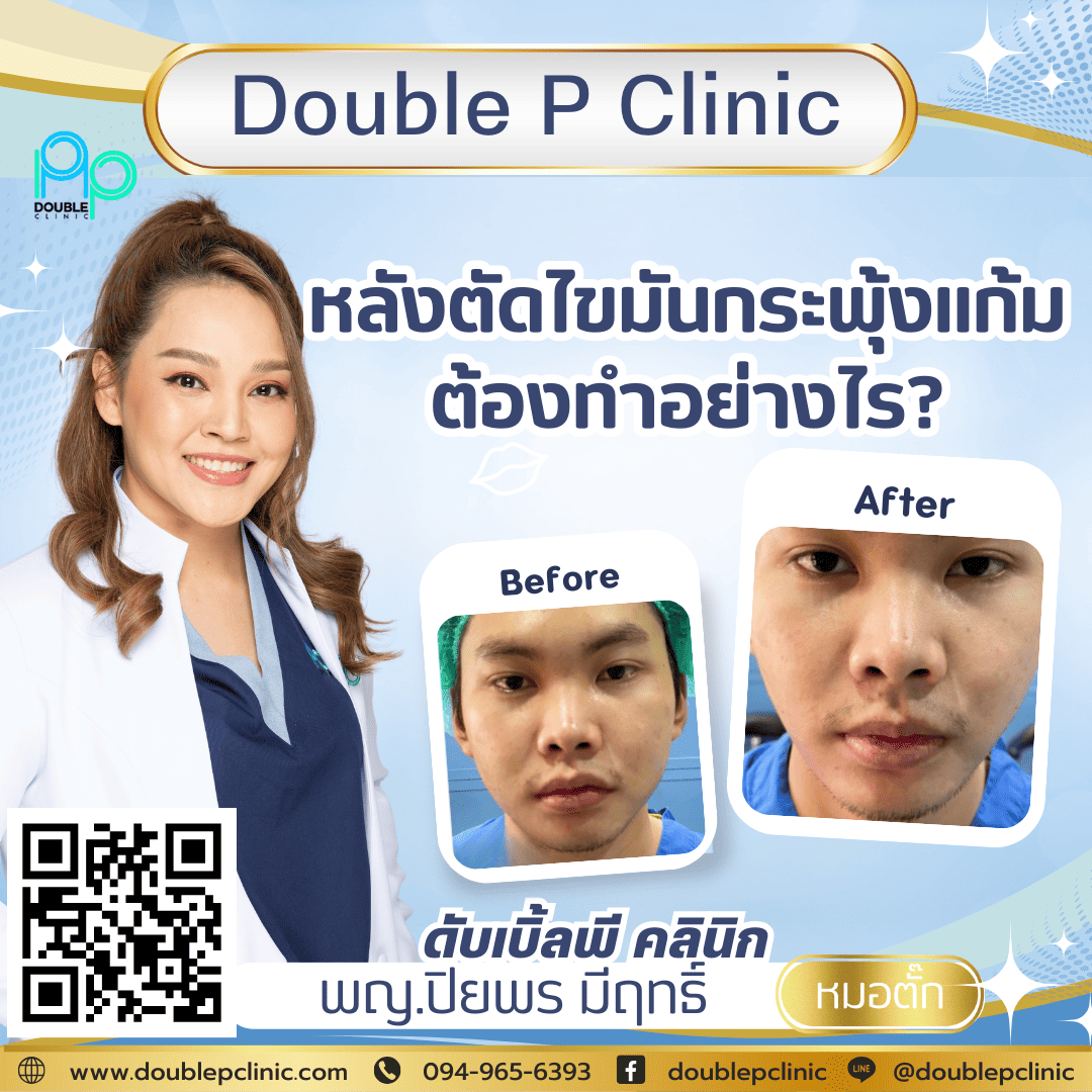 หลังตัดไขมันกระพุ้งแก้มต้องทำอย่างไร?